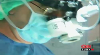 Açık Kalp Ameliyatıyla Kapalı Kalp Ameliyatının Farkı Nedir