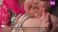 Sürekli Yemek Yeme Arzusu 8 Aylık Çocuğu 17 Kiloya Ulaştırdı