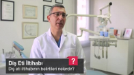 Diş Eti İltihabının Belirtileri Nelerdir