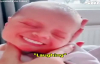 Yüz Filtresi ile Dişlerine Kavuşan Bebek 