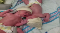 Yeni Doğmuş İkizlerin Birbirinden Ayrılmak İstemedikleri Muhteşem Anlar