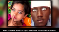 Göz Renkleriyle Tüm Dünyayı Kıskandıran 6 İnsan 