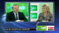 Kalın Bağırsak Kanserinin Belirtileri Nelerdir