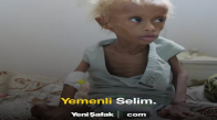 Açlığın Sembolü Yemenli Selim