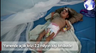 Dünya Haber: Yemende Yarım Milyon Çocuk Ölüm Tehlikesiyle Karşı Karşıya
