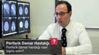 Periferik Damar Hastalığı Nasıl Teşhis Edilir
