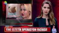 Yine estetik operasyon faciası!